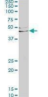 Anti-LEFTY1 Antibody