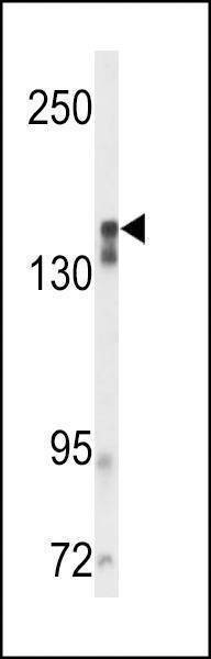 Anti-VGFR2 Antibody