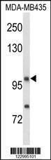 Anti-NRP1 (C-term) Antibody