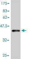 Anti-LEP Antibody