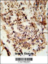Anti-ACR (C-term) Antibody