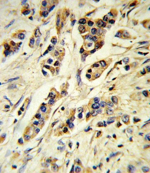 Anti-IL10 (Center) Antibody