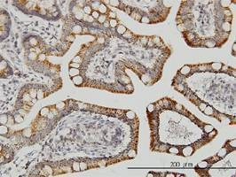 Anti-LETM1 Antibody