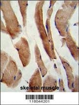 Anti-CFLAR (Center) Antibody