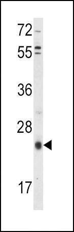 Anti-TIMP3 (Center) Antibody