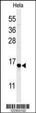 Anti-GABARAPL1 Antibody