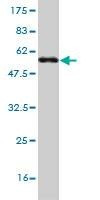 Anti-LFNG Antibody