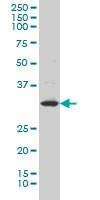 Anti-LFNG Antibody