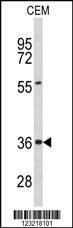 Anti-PEX16 (Center) Antibody