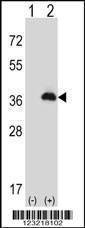 Anti-PEX16 (Center) Antibody