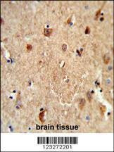 Anti-CES7 (Center) Antibody
