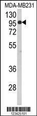 Anti-BAHD1 (C-term) Antibody