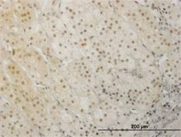 Anti-LHX1 Antibody