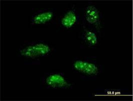 Anti-LHX1 Antibody