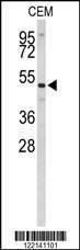 Anti-CNDP1 (C-term) Antibody