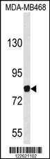 Anti-EVI5 (Center) Antibody