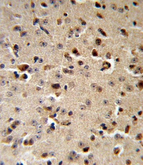 Anti-TPH2 (Center) Antibody