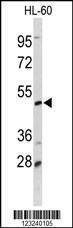 Anti-DCP2 (Center) Antibody