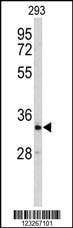 Anti-CRELD2 (C-term) Antibody