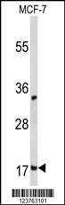 Anti-DSTN (Center) Antibody