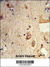 Anti-DSTN (Center) Antibody