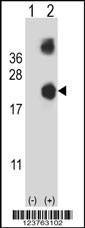 Anti-DSTN (Center) Antibody
