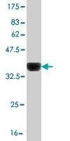 Anti-LHX4 Antibody