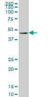 Anti-LHX4 Antibody