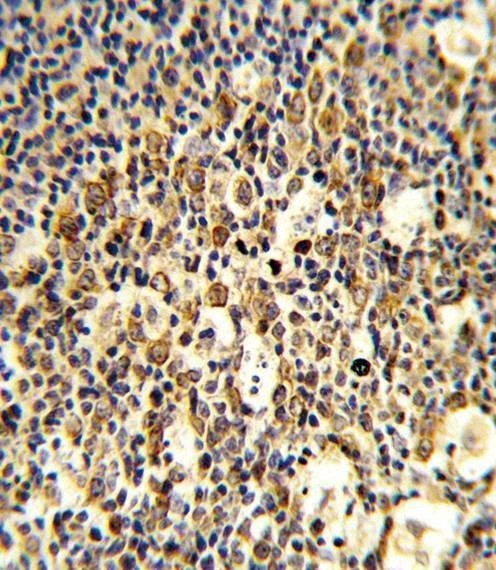 Anti-FCGR1B (C-term) Antibody