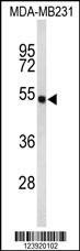 Anti-FLAD1 (C-term) Antibody