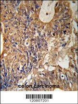 Anti-GSTP1 (Center) Antibody