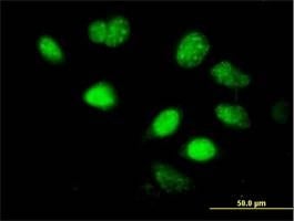 Anti-LHX5 Antibody