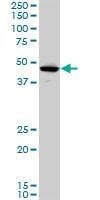 Anti-LHX5 Antibody