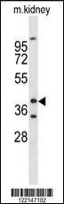 Anti-FOXL1 (Center) Antibody
