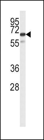 Anti-SLC22A6 (C-term) Antibody