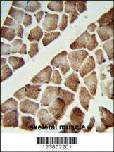 Anti-ATP5C1 (N-term) Antibody