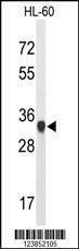 Anti-ATP5C1 (N-term) Antibody