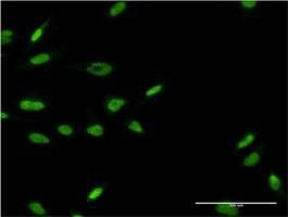 Anti-LHX6 Antibody