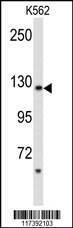 Anti-PLCB2 (N-term) Antibody