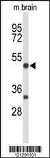 Anti-MEF2A (Center) Antibody