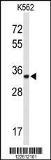 Anti-ATP1B2 (Center) Antibody