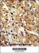 Anti-ATP1B2 (Center) Antibody
