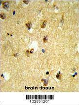 Anti-KCTD12 (Center) Antibody
