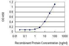 Anti-LIMA1 Antibody