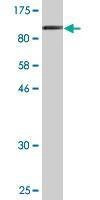 Anti-LIMA1 Antibody