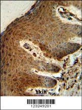 Anti-PTMS (C-term) Antibody