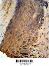Anti-GFPT2 (Center) Antibody