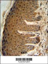 Anti-EFTUD2 (Center) Antibody