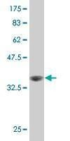 Anti-LIMK1 Antibody