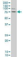 Anti-LIMK1 Antibody